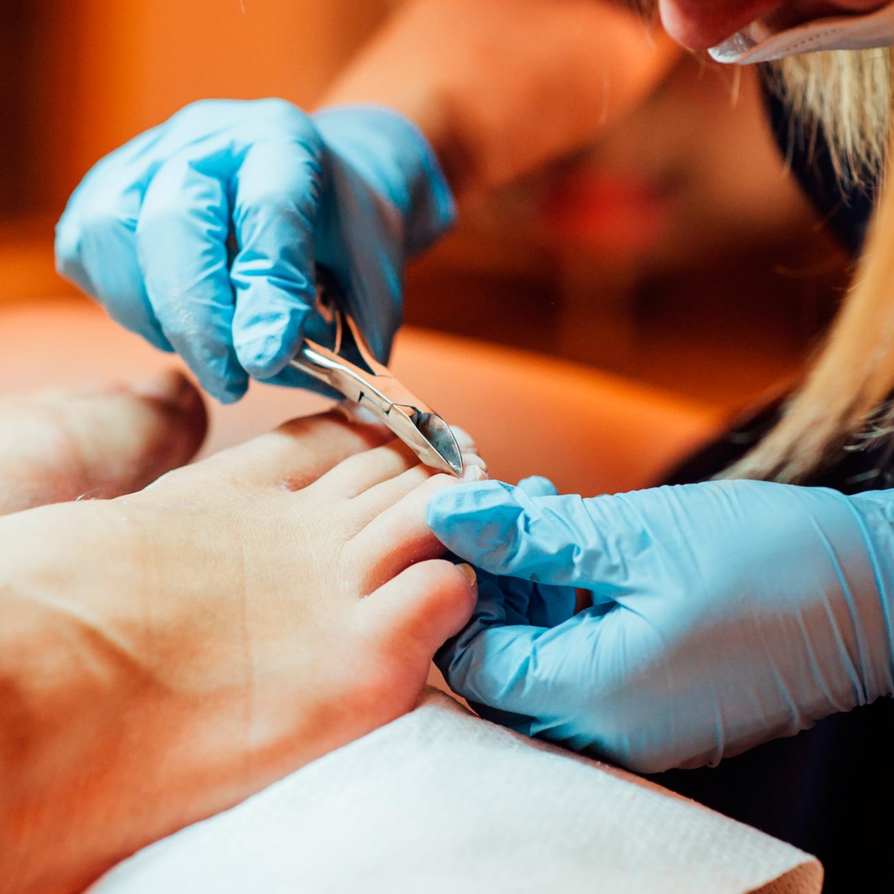 Ingrown Toenails Bondi Junction, Barangaroo & St Ives Nail Surgery