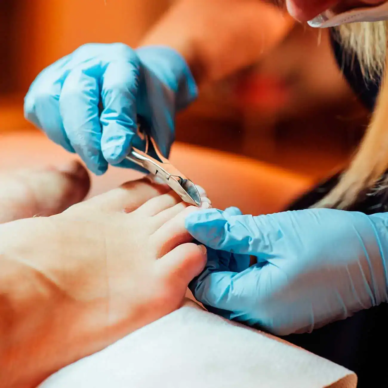 ingrown toenails Bondi Junction, St Ives and Bondi Junction